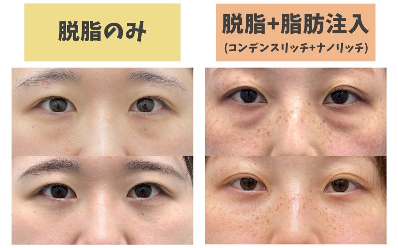 脂肪を入れた場合と入れなかった場合